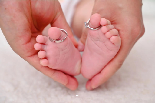 海西怀孕妊娠线不明显 海西怀孕妊娠线不明显